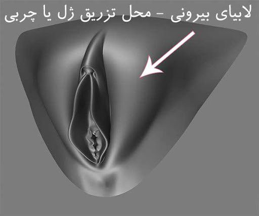 زیباسازی واژن با تزریق چربی